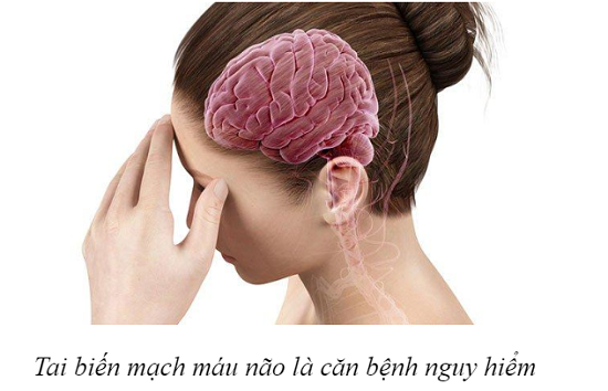 Thực phẩm bảo vệ sức khỏe Nattospes: Giải pháp hỗ trợ điều trị và phòng ngừa tai biến mạch máu não