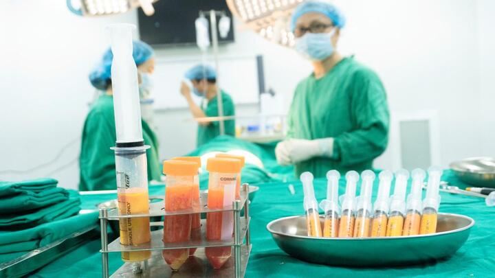 Hút mỡ triệt để, không để lại dấu vết với công nghệ Lipo plasma