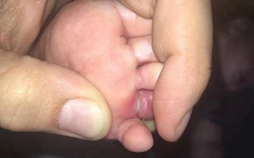 Tin tức đời sống mới nhất ngày 15/7/2019: Con suýt đứt ngón chân vì 1 sợi tóc trên giường ngủ