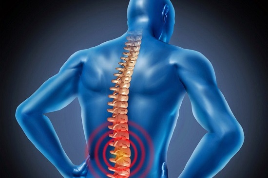 Những điều cần biết trong việc hỗ trợ điều trị bệnh thoái hóa cột sống