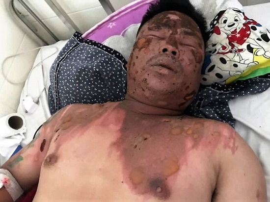 Hỏi tuổi bố bạn nhậu, người đàn ông hứng trọn nồi lẩu đang sôi vào mặt