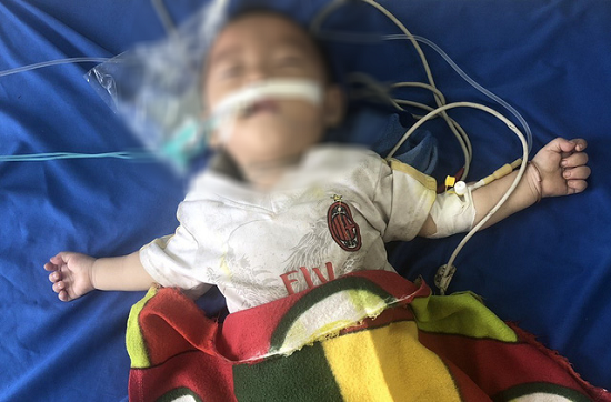 Lào Cai: Bé trai 12 tháng tuổi nguy kịch vì ngộ độc thuốc phiện do bà nội tin lời thầy lang