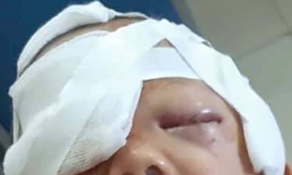 Liên tục xảy ra những trường hợp người bị chó tấn công trọng thương