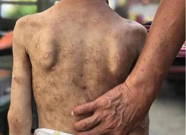 Bà nội nhẫn tâm dùng dây điện, ống nước đánh đập cháu gái 7 tuổi