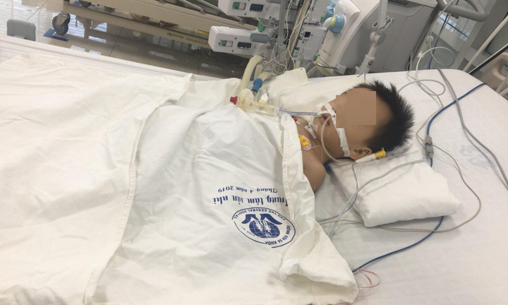 Bé trai 27 tháng tuổi nguy kịch nghi do uống thuốc hạ sốt paracetamol quá liều