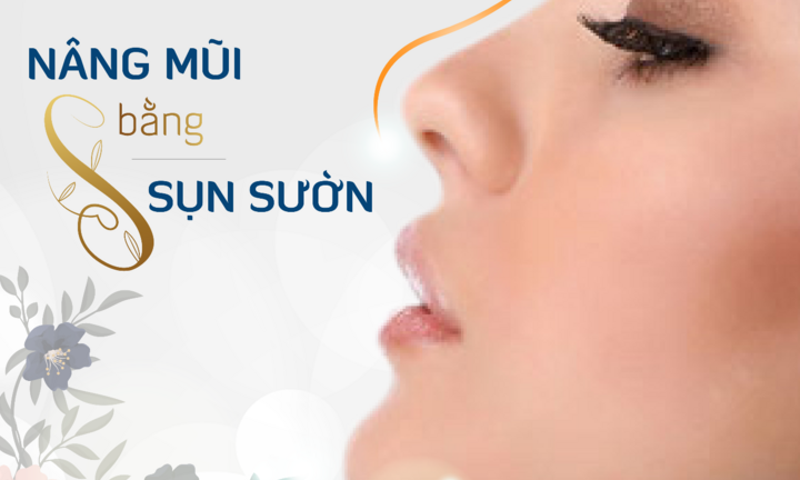 Nâng mũi bằng sụn sườn 