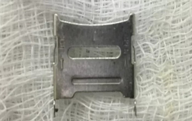 Thấy con gái 2 tuổi quấy khóc, mẹ tá hỏa khi biết con nuốt khay sim điện thoại