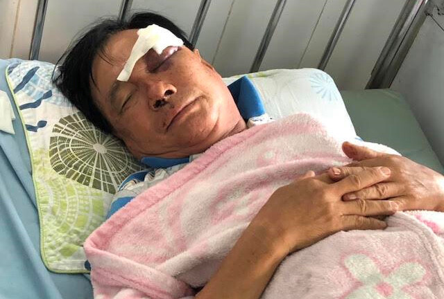 Đồng Tháp: Tranh chấp tài sản, bố vợ bị hai con rể đánh nhập viện