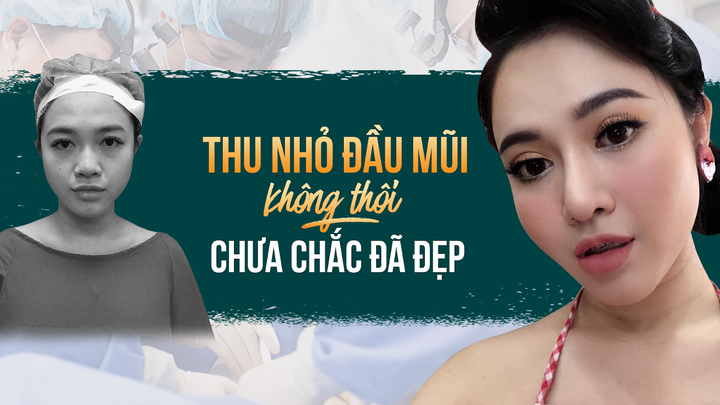 Chỉ thu nhỏ đầu mũi, liệu dáng mũi có đẹp như bạn mong muốn?