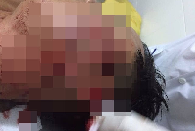 Sóc Trăng: Điều tra vụ người đàn ông đập ly bia vào mặt Đại úy CSGT