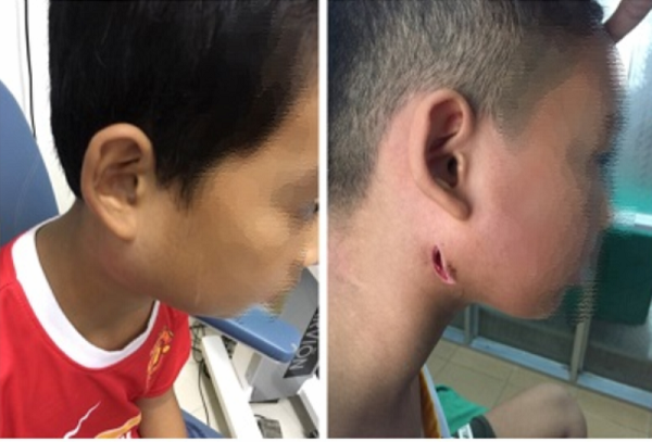 Tin tức đời sống mới nhất ngày 16/9/2019: Điều trị thành công cho một trẻ nhiễm