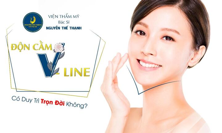 Độn cằm V-line có duy trì trọn đời không?