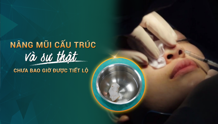 Sự thật về nâng mũi cấu trúc mà các thẩm mỹ viện chưa bao giờ dám tiết lộ