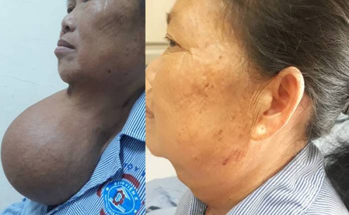 Nhà nghèo lại ở xa, bà cụ 20 năm