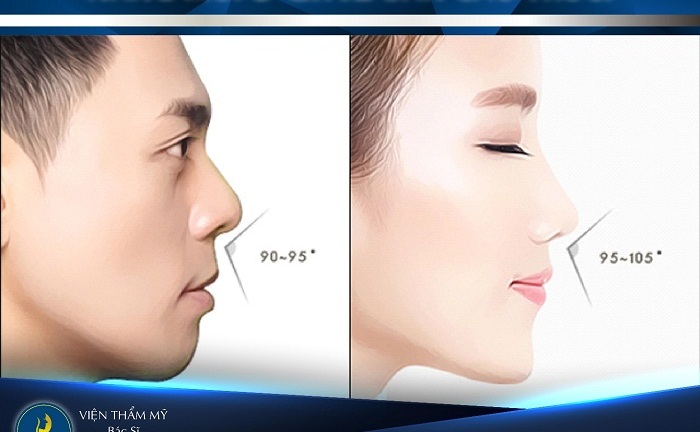 Mũi đẹp không lo biến chứng với nâng mũi S-Line bán cấu trúc