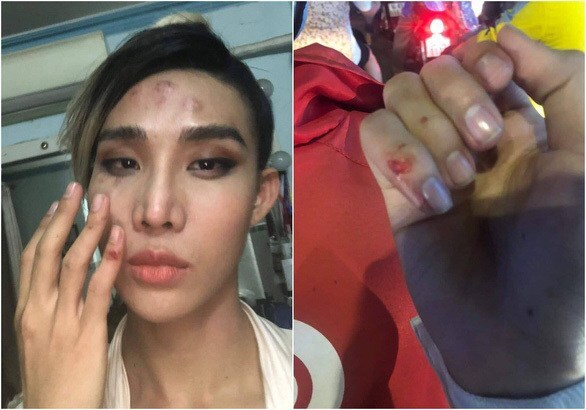 Người mẫu The Face tố bị tài xế Go-Viet hành hung, gây thương tích