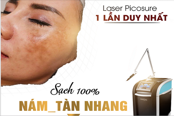 Thẩm mỹ viện Quốc Tế Bắc Âu trị nám 1 lần duy nhất - đánh bay nám xua tan tàn nhang