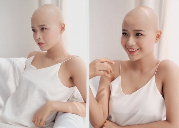 Nụ cười rạng rỡ của