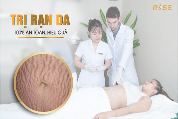 Trị rạn 1 lần duy nhất tại thẩm mỹ viện Quốc tế Rose