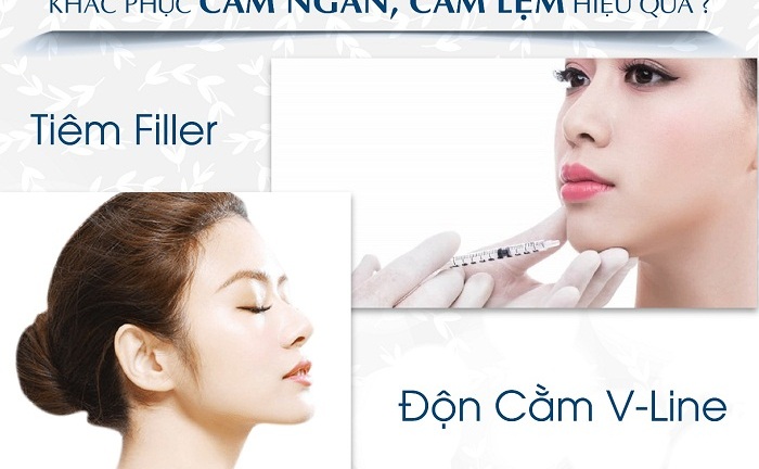 Những giải pháp nào khắc phục cằm ngắn, cằm lẹm hiệu quả?