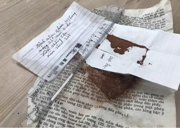 Uống thuốc nam chữa bệnh, bé 14 tháng tuổi nhiễm độc chì nặng