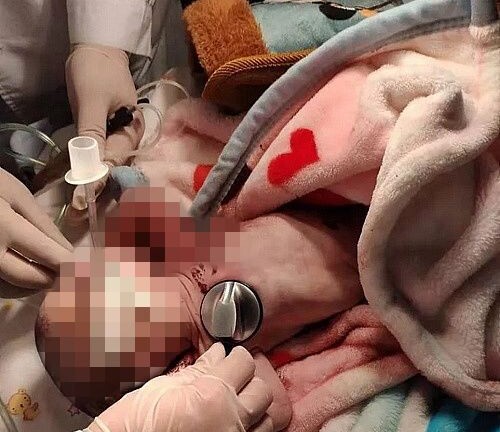 Bắt giữ người mẹ nhẫn tâm vứt con sơ sinh trong thùng rác