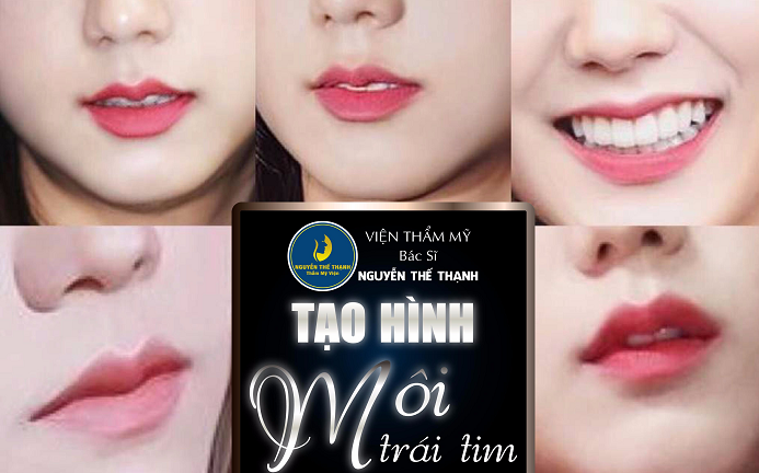 Tạo hình môi trái tim – Cho bờ môi thêm căng mọng quyến rũ 