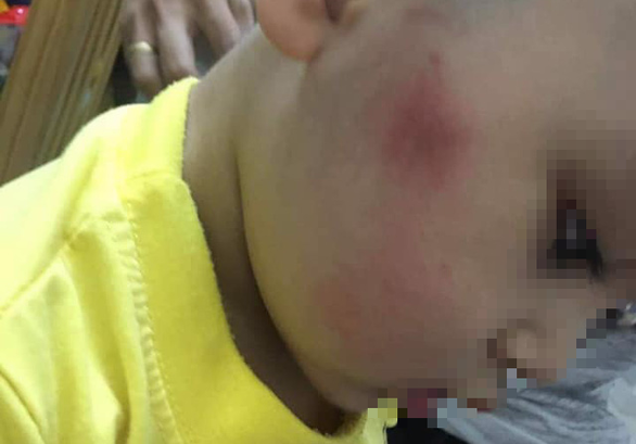 Đánh vào má, mông trẻ nhưng nói dối là ngã, 2 cô giáo bị kỷ luật