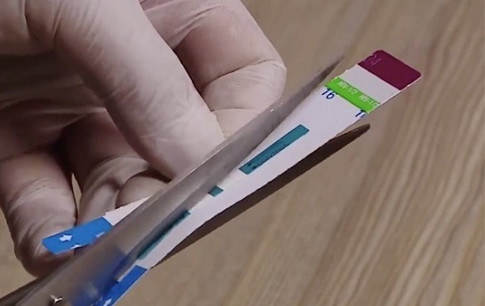 Tin tức thời sự mới nóng nhất hôm nay 18/12/2019: Phó khoa vi sinh BV Xanh Pôn chỉ đạo cắt đôi que thử HIV, viêm gan B