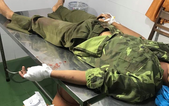 Truy tìm nhóm lâm tặc chém kiểm lâm trọng thương để giải cứu đồng bọn