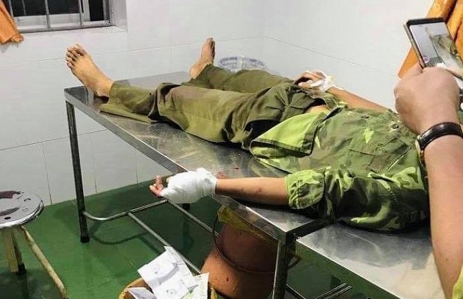 Vụ kiểm lâm bị nhóm lâm tặc chém trọng thương: Bắt 5 đối tượng