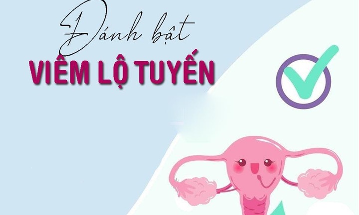 Đốt viêm lộ tuyến bao lâu thì khỏi?