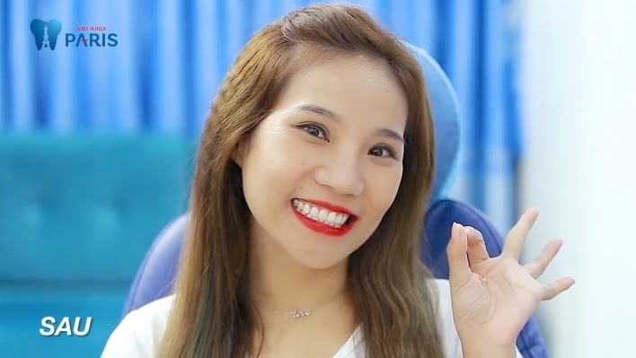 Tết này Việt Kiều về nước thẩm mỹ răng ở đâu?