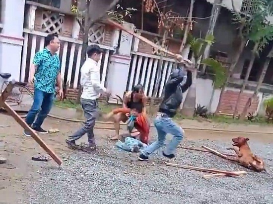 Vụ cụ bà 86 tuổi bị chó Pitbull cắn nát tay: Nhân chứng chưa hết bàng hoàng kể lại sự việc