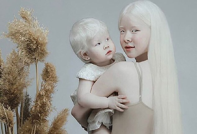 Sửng sốt trước diện mạo khác lạ của hai chị em bạch tạng người Kazakhstan