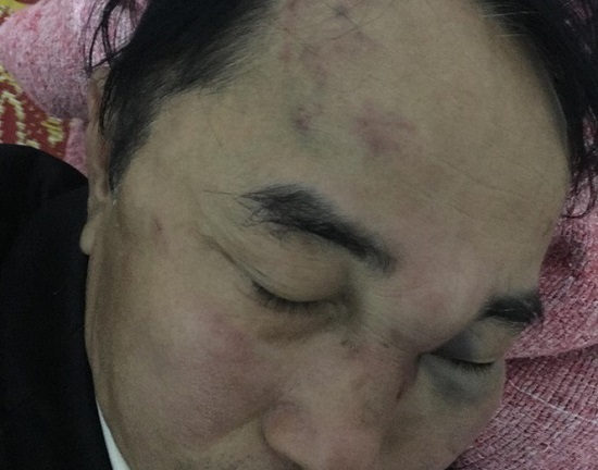 Nghệ An: Nam bác sỹ bị nhân viên quán trà chanh hành hung hội đồng