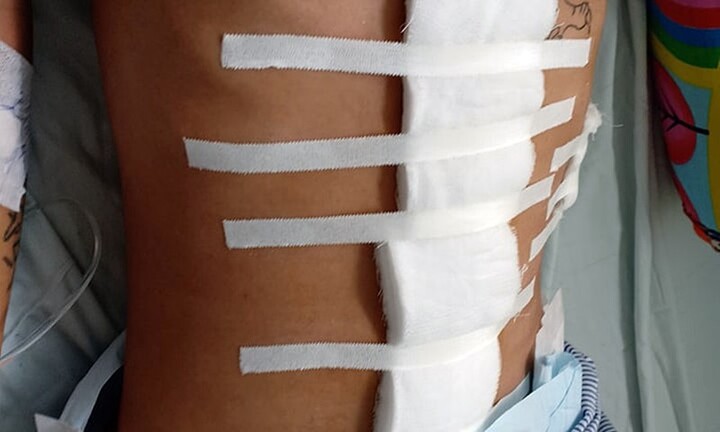 Nổ súng bắn 4 người bị thương, giang hồ 