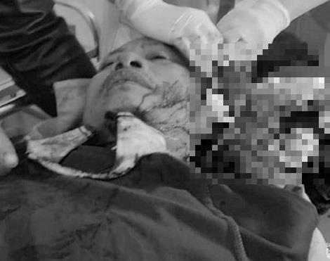 Nghệ An: Can ngăn nhóm thanh niên xô xát, công an xã bị chém trọng thương