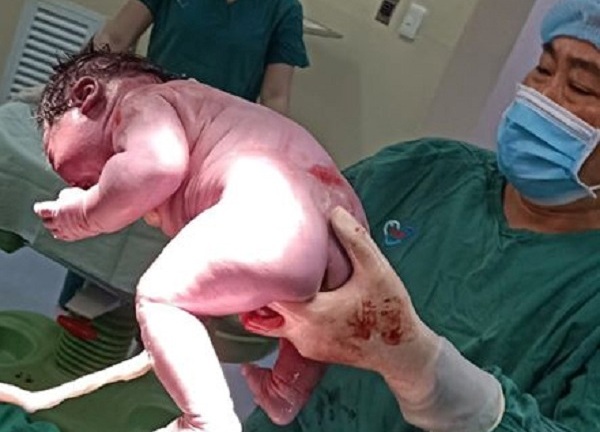 Khánh Hòa: Sản phụ sinh bé trai 