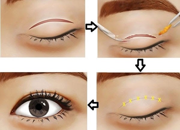 Giải pháp xóa bỏ mọi dấu vết thời gian cho
