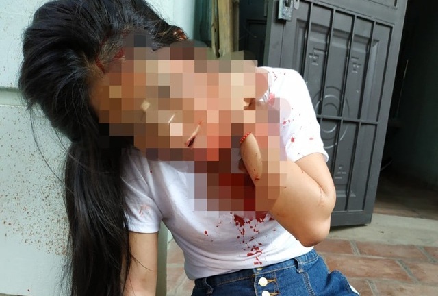 Điều tra vụ