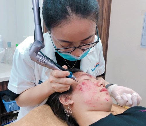 Phải làm gì khi mụn đầu đen tái đi tái lại? 