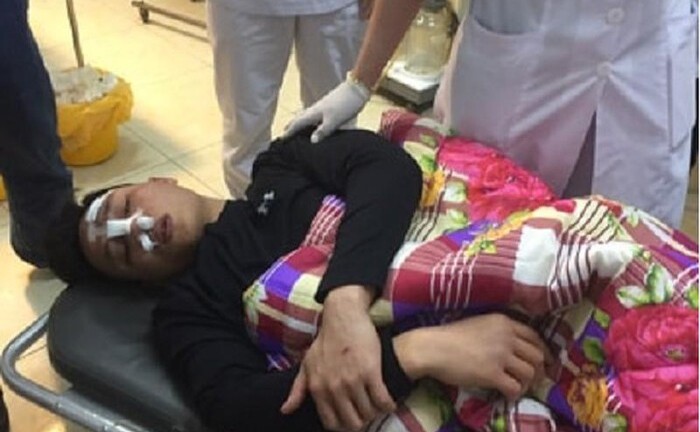 Vụ bác sĩ bị đánh gãy sống mũi ở Hải Dương: Hé lộ nguyên nhân dẫn đến ẩu đả