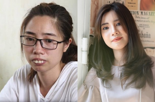 Cô gái Phú Thọ mong tìm được tình yêu sau khi “đập mặt đi xây lại”