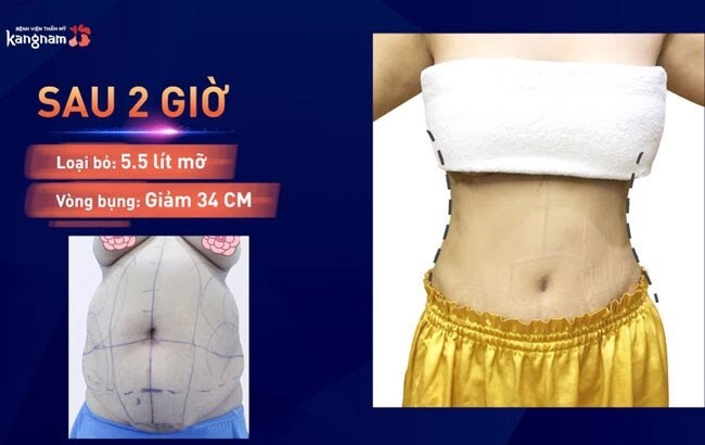 Những sai lầm “tai hại” về việc ăn kiêng khiến bạn mãi chẳng giảm cân nổi!