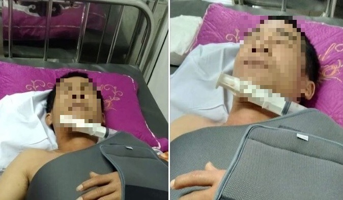 Nghệ An: Lái xe làm đứt dây mạng, người đàn ông bị hàng xóm vác dao truy sát 