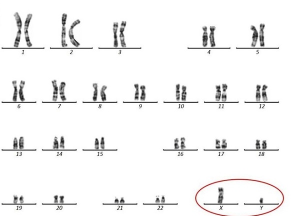 Tin tức đời sống mới nhất ngày 19/4/2020: Người đàn ông không có tinh trùng vì đột biến hiếm gặp