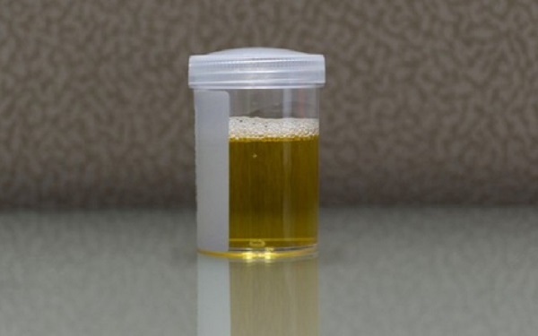 Tin tức đời sống mới nhất ngày 20/4/2020: Lần đầu phát hiện người tiểu ra cồn