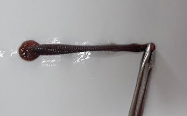 Tin tức đời sống mới nhất ngày 23/4/2020: Đỉa dài 5 cm sống trong mũi người phụ nữ