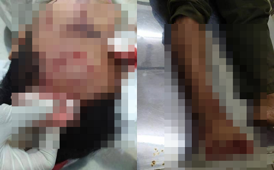 Điều tra vụ kiểm lâm viên bị 10 tên côn đồ xông vào đánh trọng thương